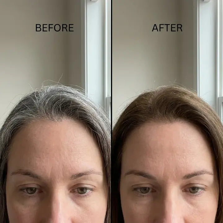 Theresa, before and after