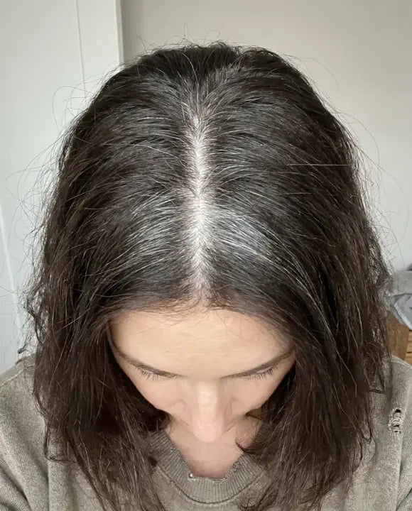 The gray stripe at the part at week three